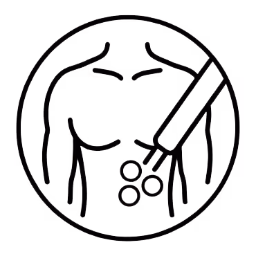 Gynäkomastie Technik - Fettabsaugung Symbol in Schwarz