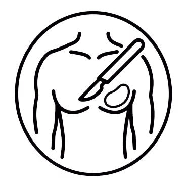 Gynäkomastie Technik -Drüsenentfernung Symbol in Schwarz