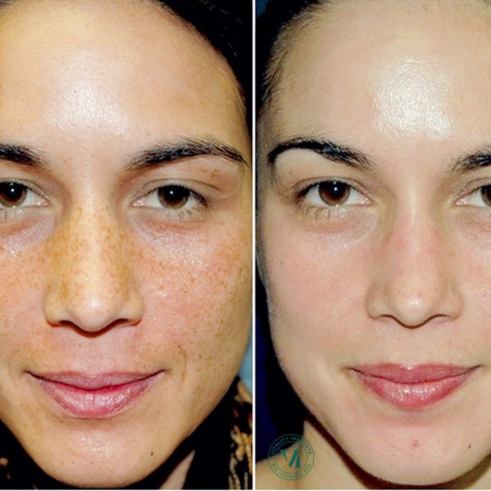 About AMMA Aesthetics