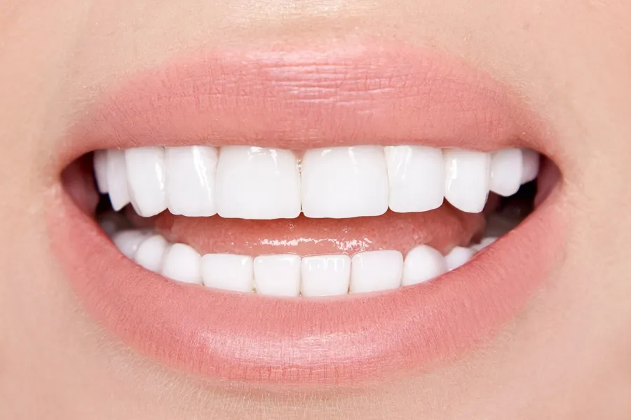 after teeth whitening in Florence SC