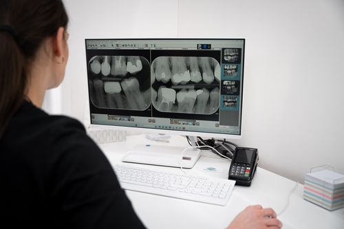 Rentgen zubů Praha