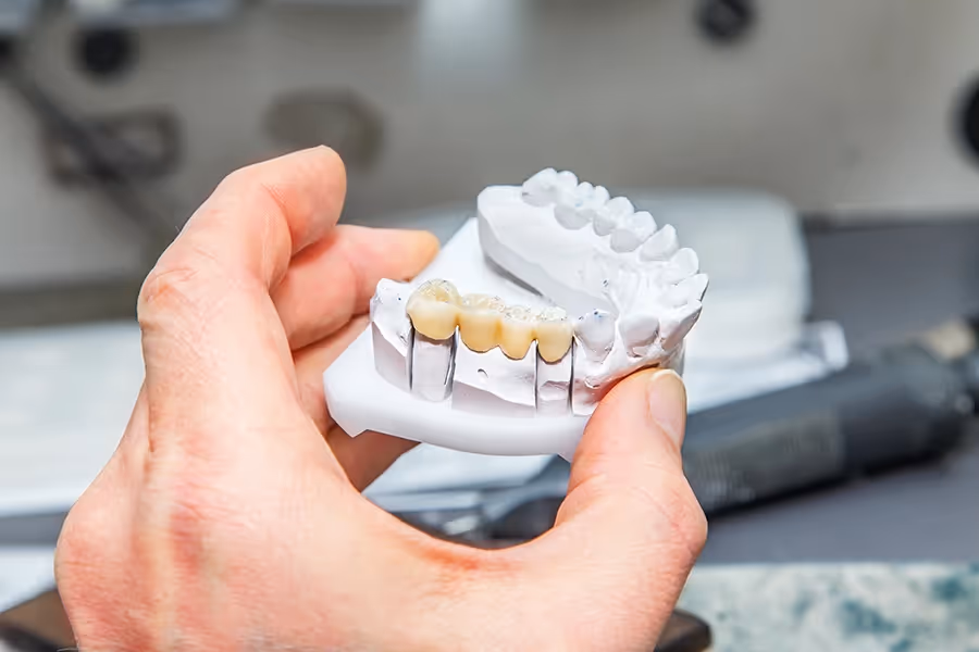A person holding a model of a dental bridge.