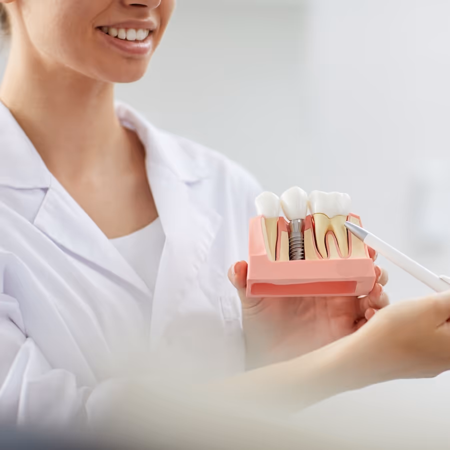 A woman holding a model of a dental implant.