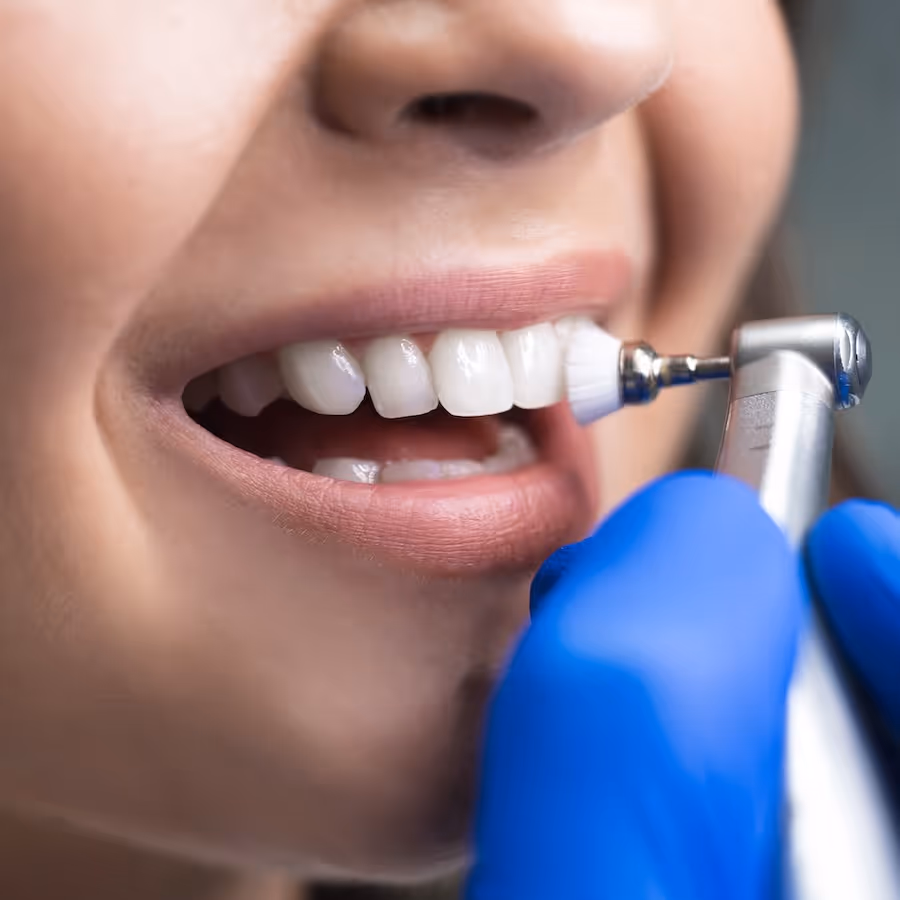 A close up of a person having a dental polish.