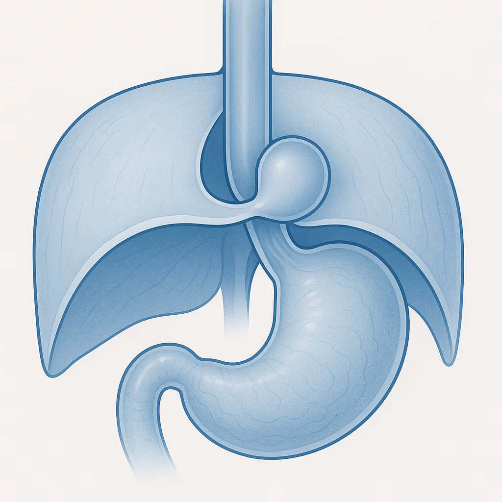 AI-generated featured image for Lifetime Surgical blog post: Hiatal Hernia