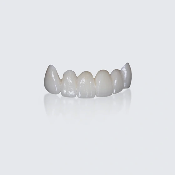 Porcelain Fused Zirconia (PFZ)