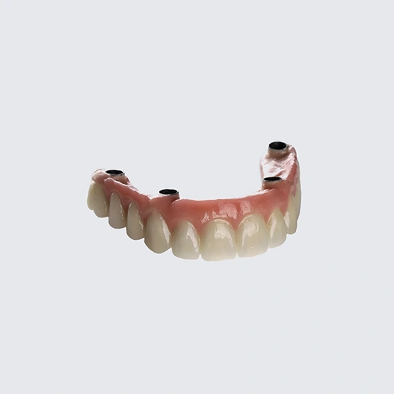 Protesi implantare fissa