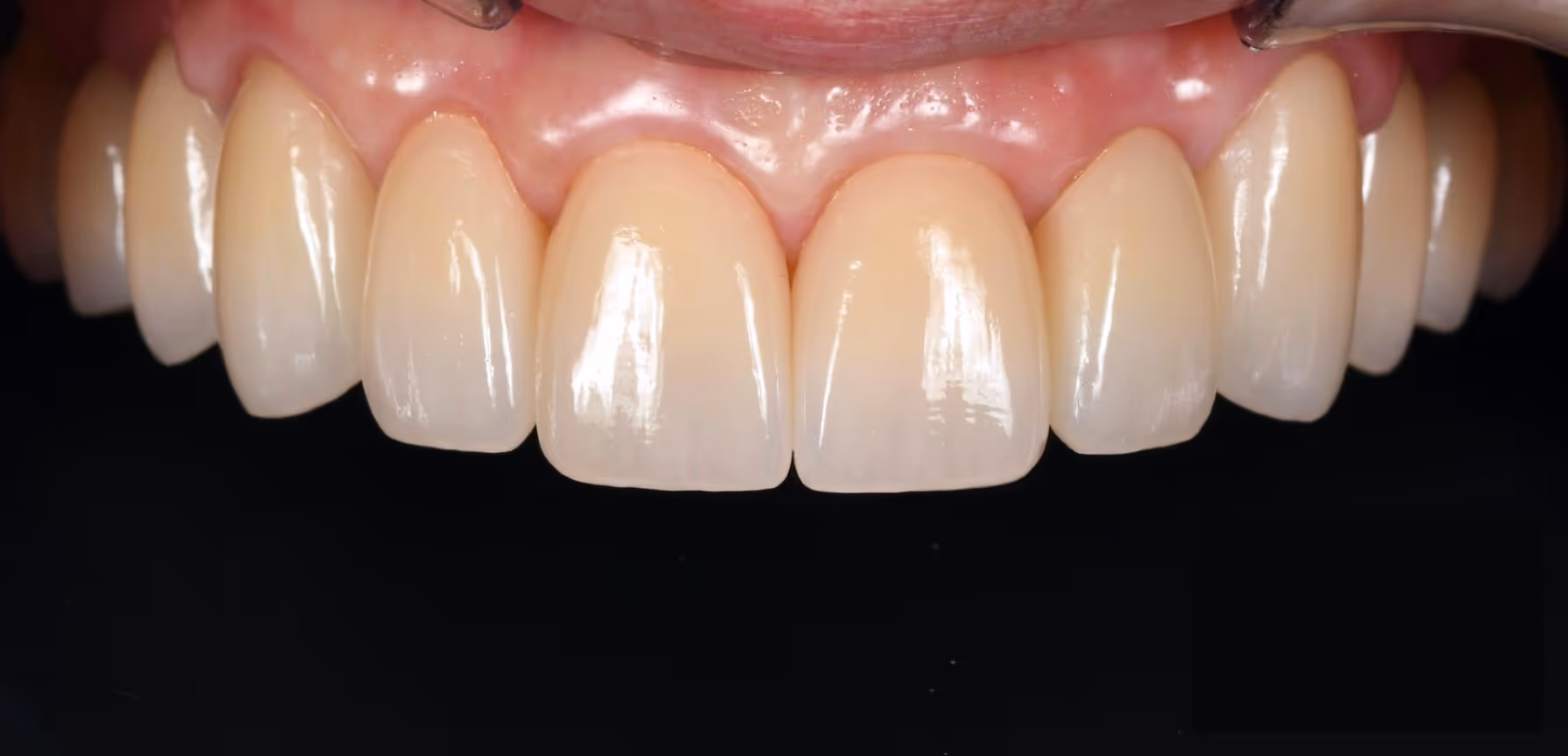 Before Image