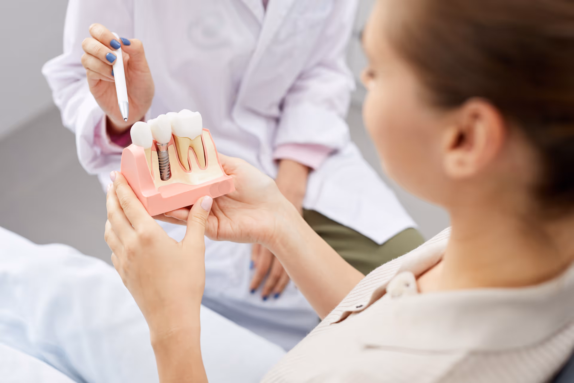 Dental Implants
