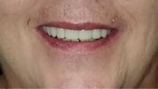 A close up of a person's mouth smiling.
