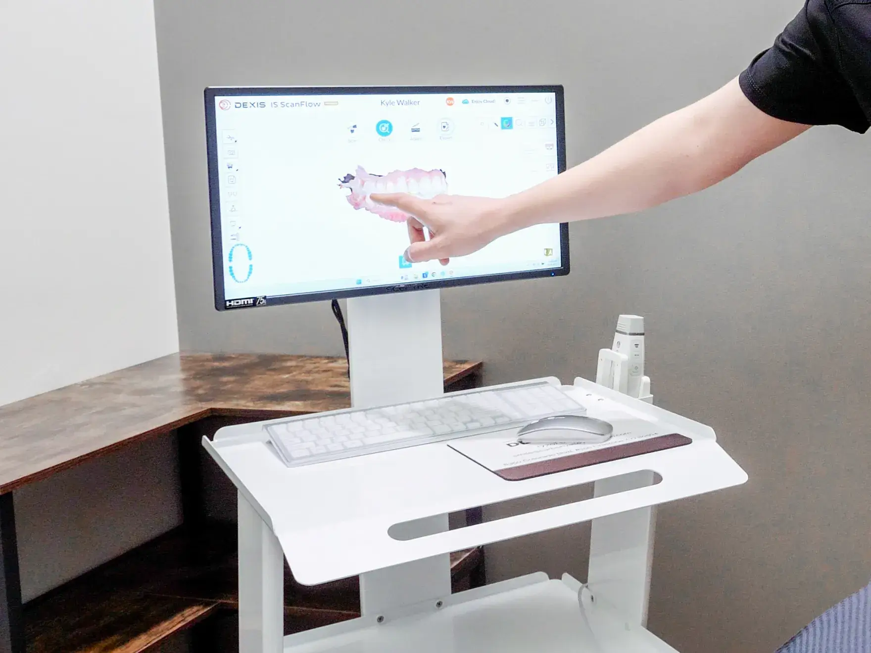 A person wearing blue gloves applies pink glue to dental prosthetics on a black tray.