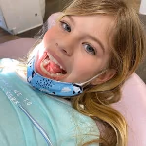 Invisalign Rubber Bands installation