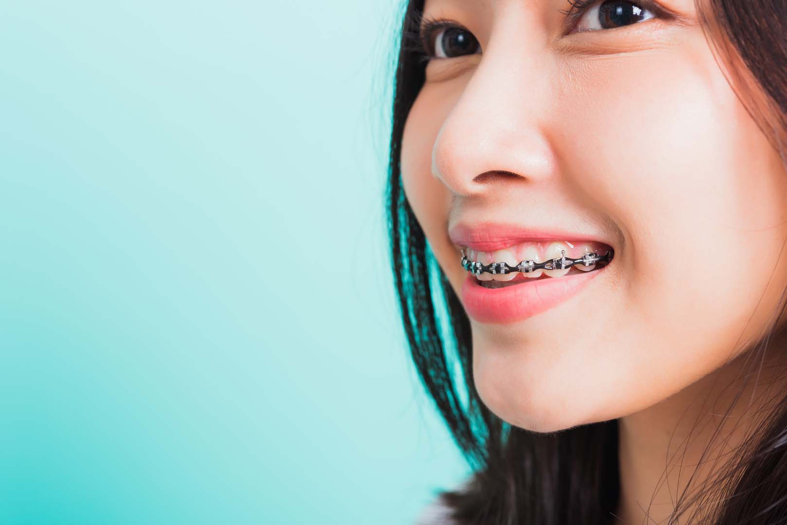 Braces emergency care at Gardner & La Rochelle Orthodontics in Richmond, VA