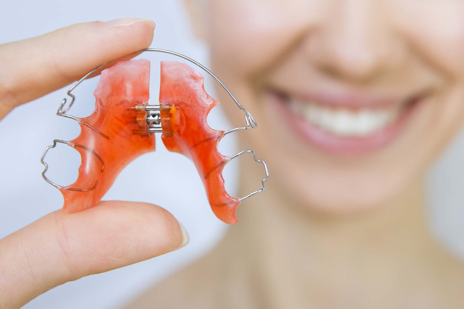 Retainer repair at Gardner & La Rochelle Orthodontics in Richmond, VA