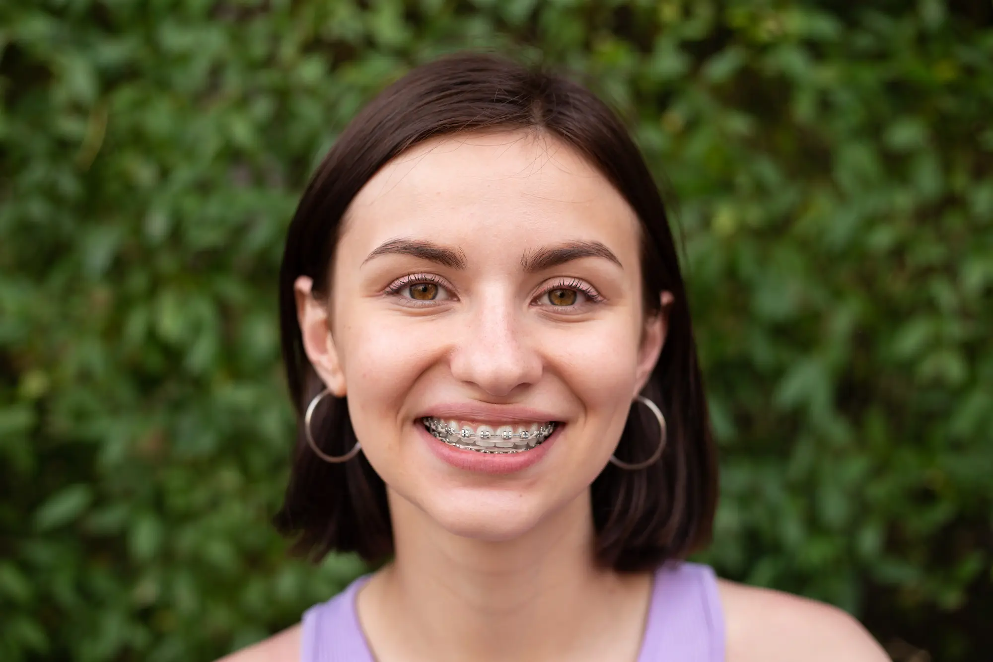 Is Orthodontic Treatment Worth It?, Gardner & La Rochelle Orthodontics blog