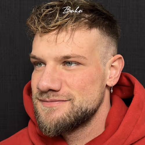 Seitliches Porträt von Marc, Patient in der Praxis von Dr. Berkei, mit kurzem Haar und rotem Kapuzenpullover.