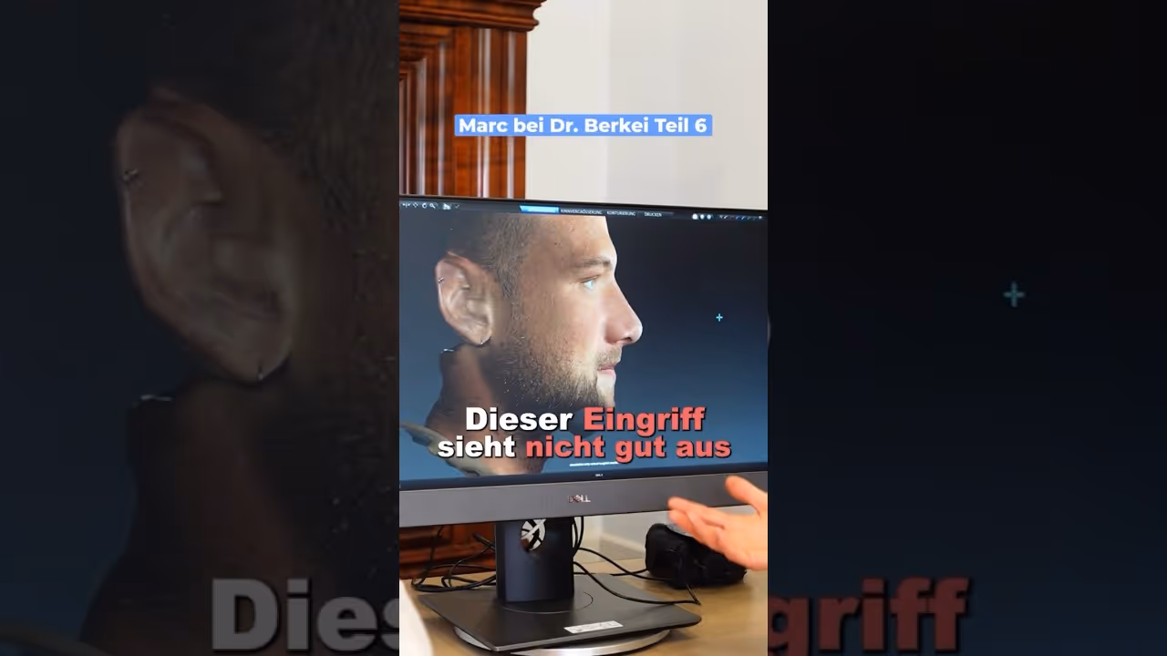 Typ Veränderung durch eine kleine Nase