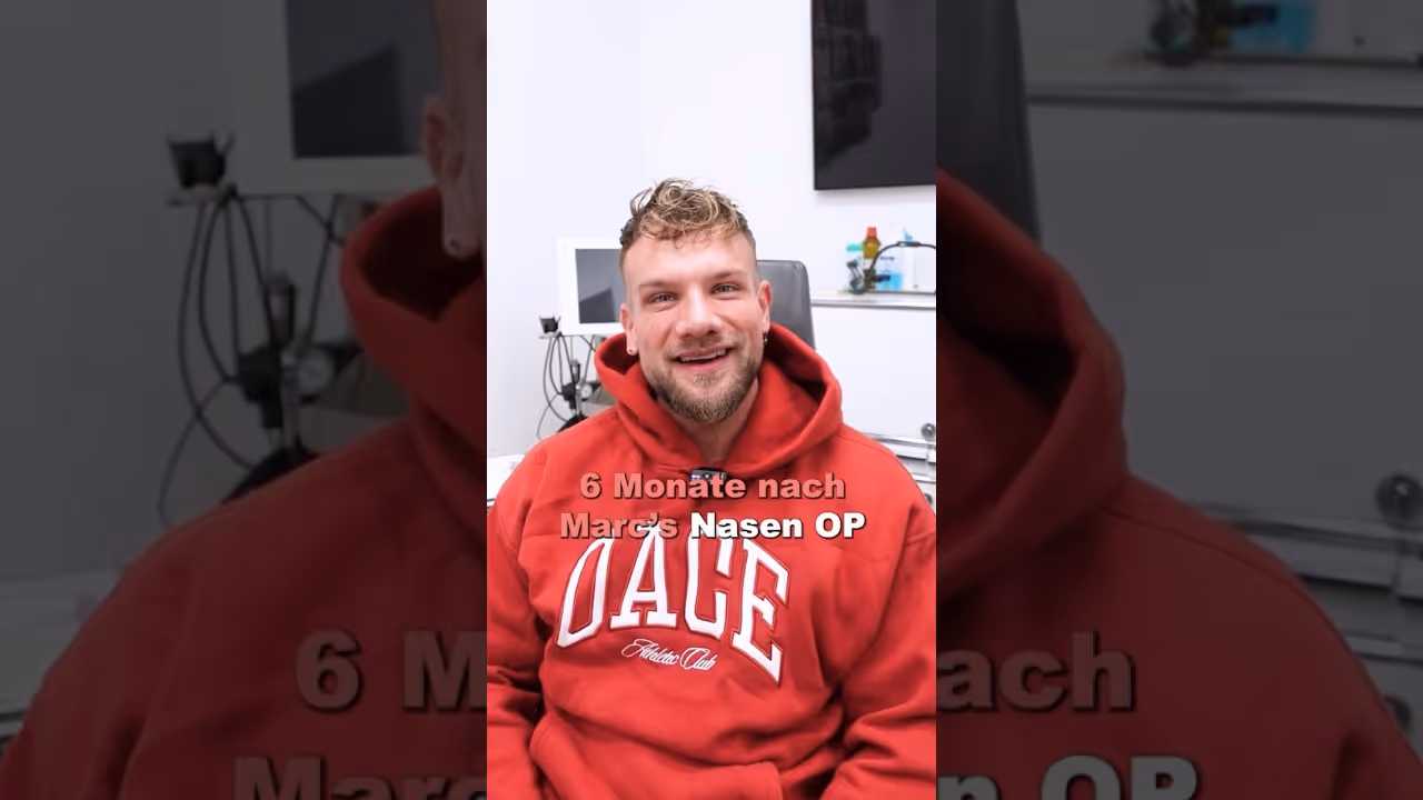 Wir hatten Besuch von Marc 6 Monate nach seiner Nasen-OP