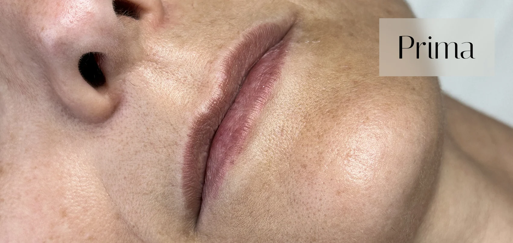 Risultato dermopigmentazione labbra presso centro estetico Lugano prima del trattamento