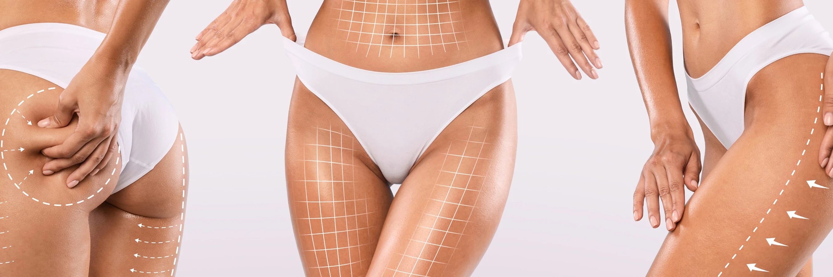 Trattamento corpo con macchinario estetico su addome o fianchi, ambiente cabina professionale, luce calda