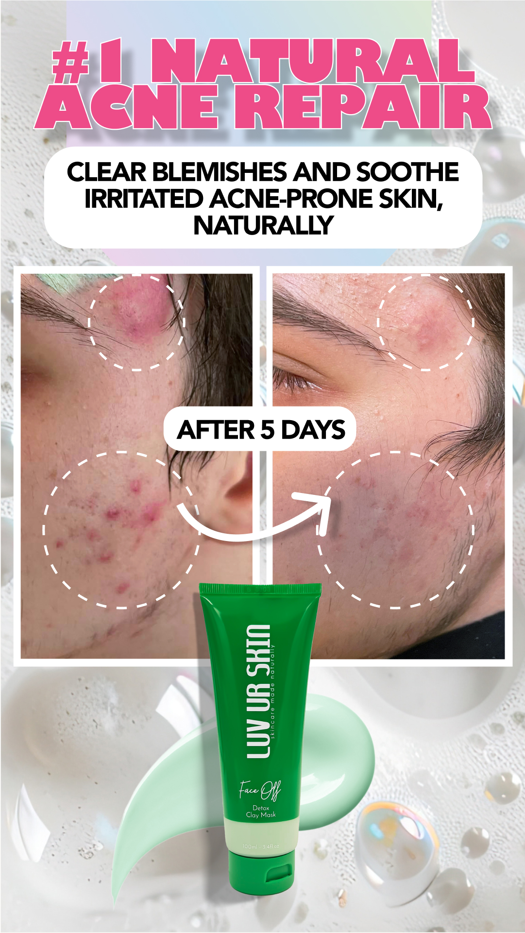 Luv Ur Skin Paid Social