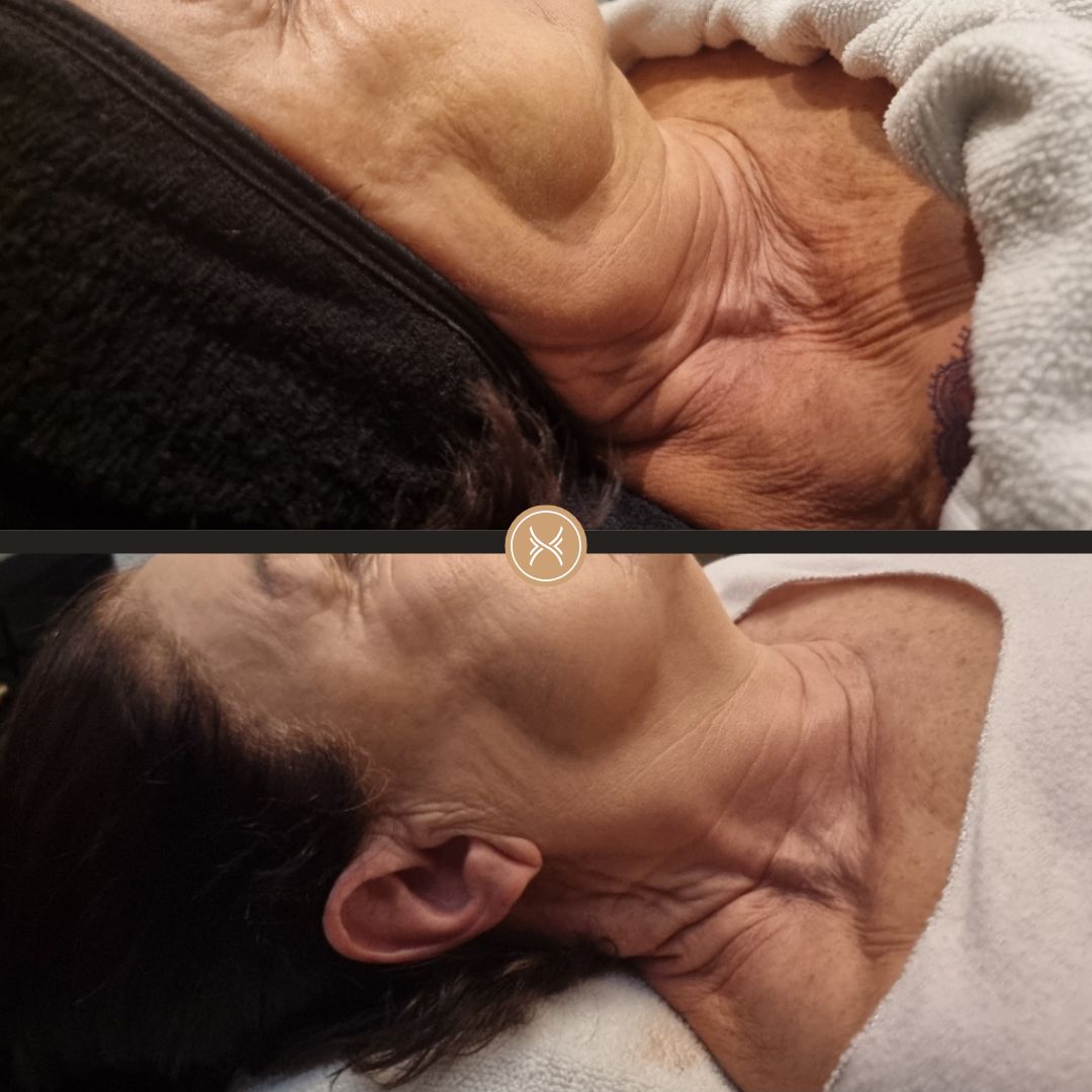 3 Jetpeel et 3 Soins du Visage Profonds