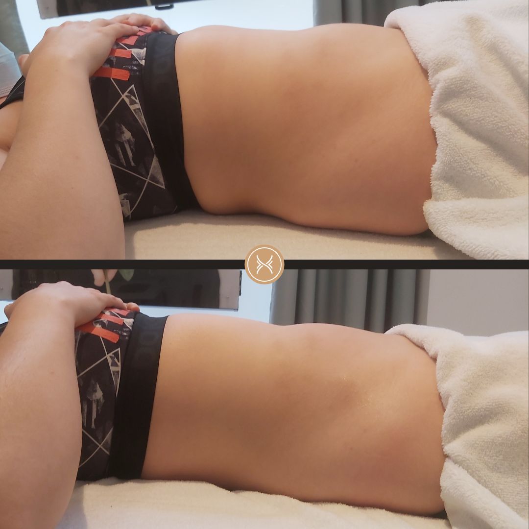 Renata