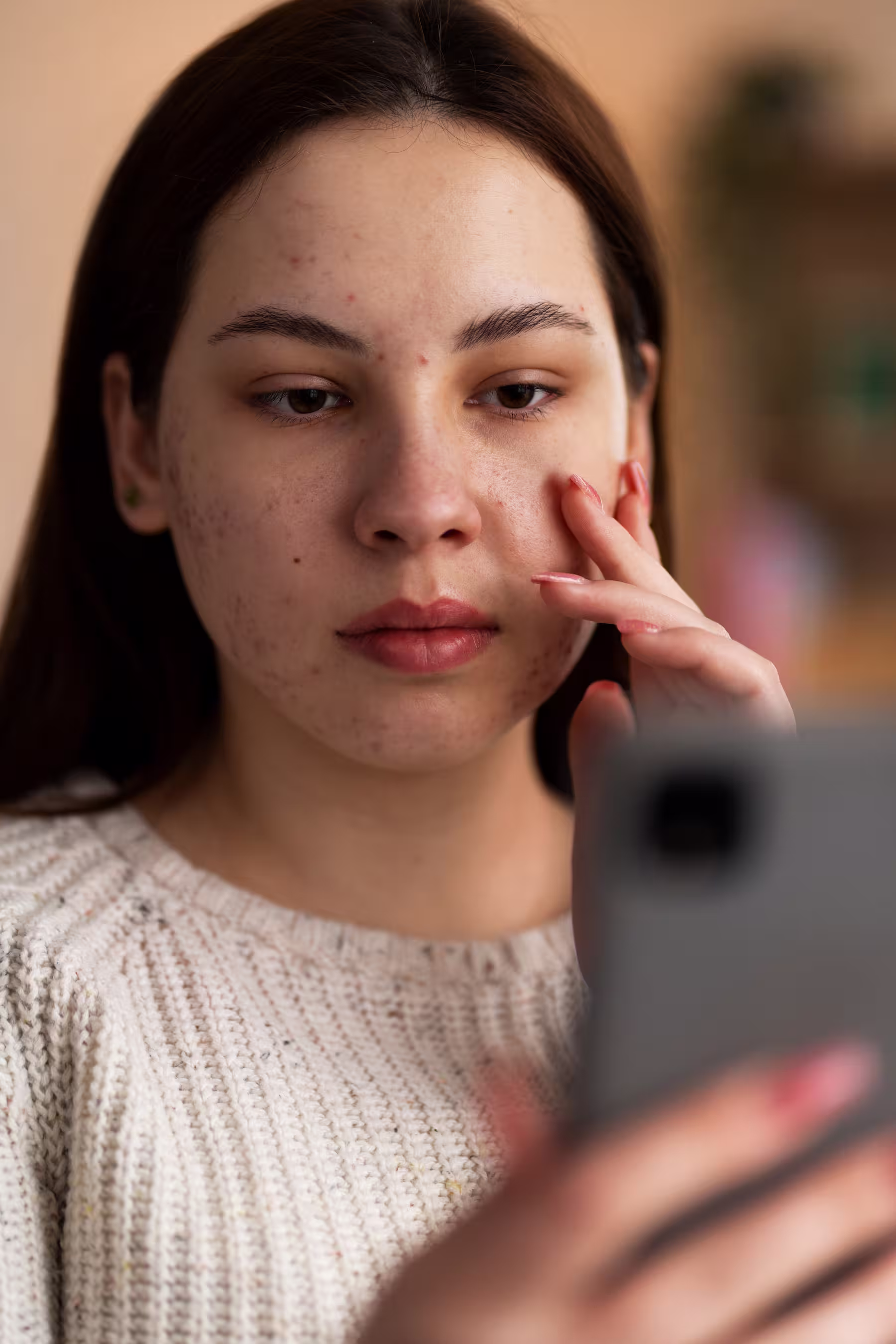 Jeune femme touchant ses joues avec des boutons et imperfections tout en regardant son téléphone.