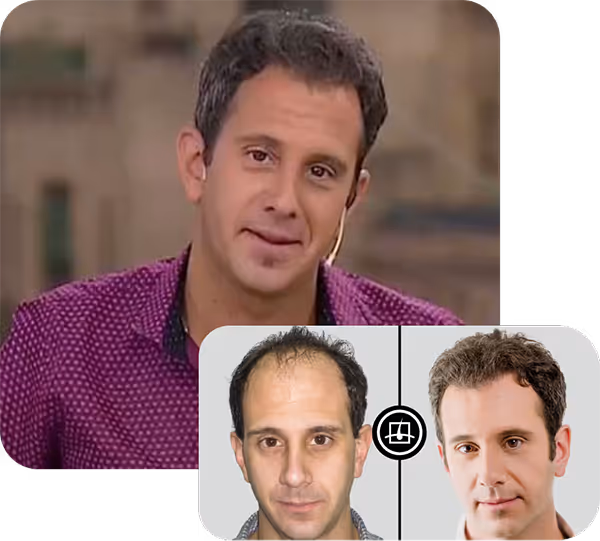 Bertolotii caso