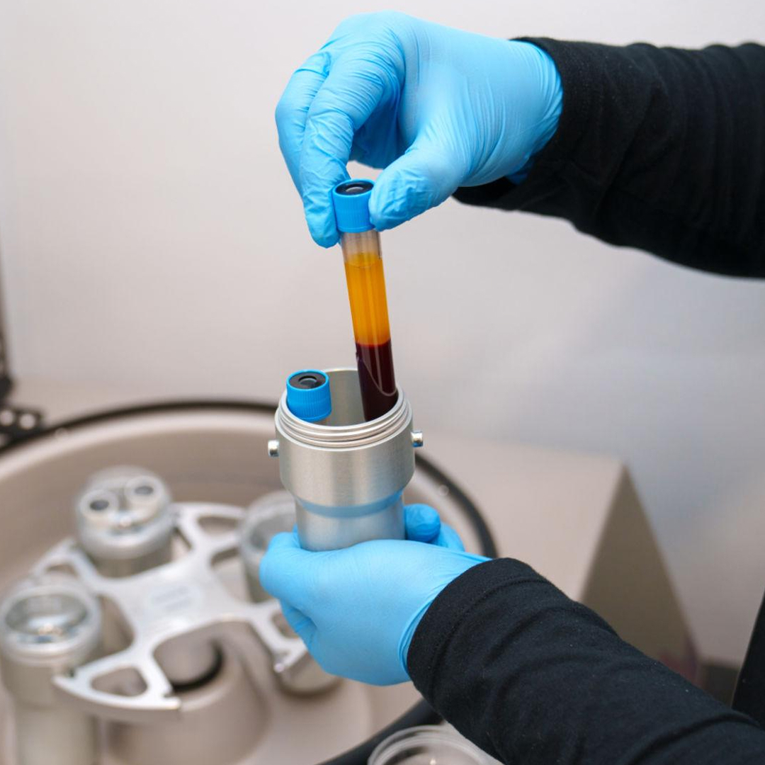 PRP process