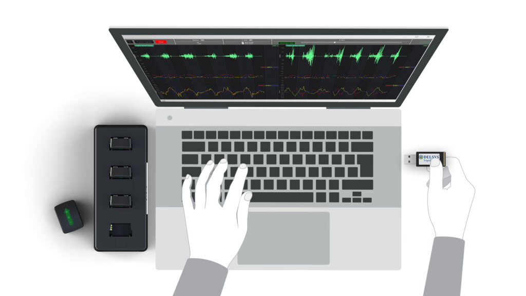 Trigno Lite System by Delsys