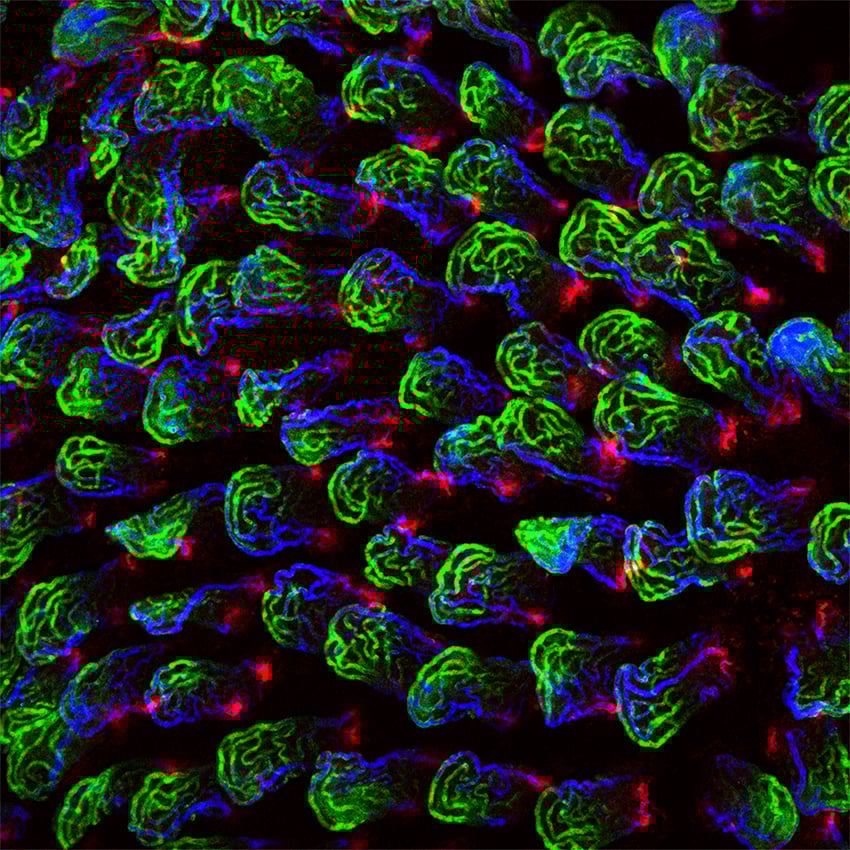 Fluorescent microscopy of a mouse small intestinal villi’s finger-like projections