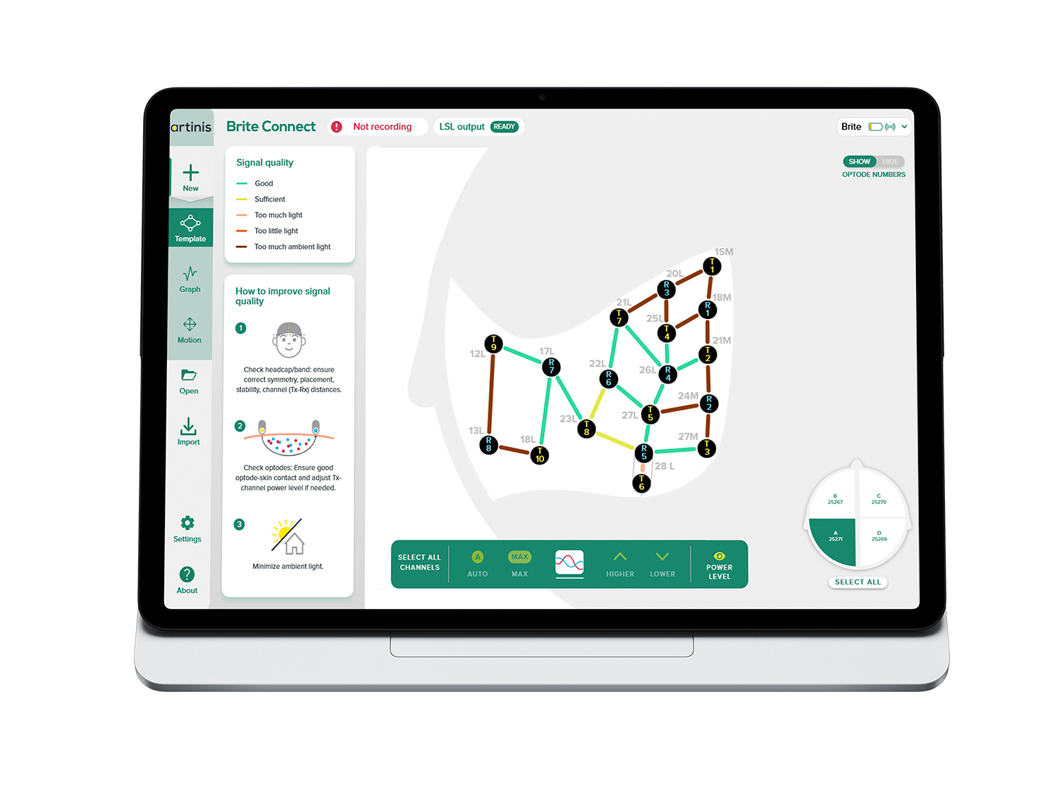Artinis Brite Connect
