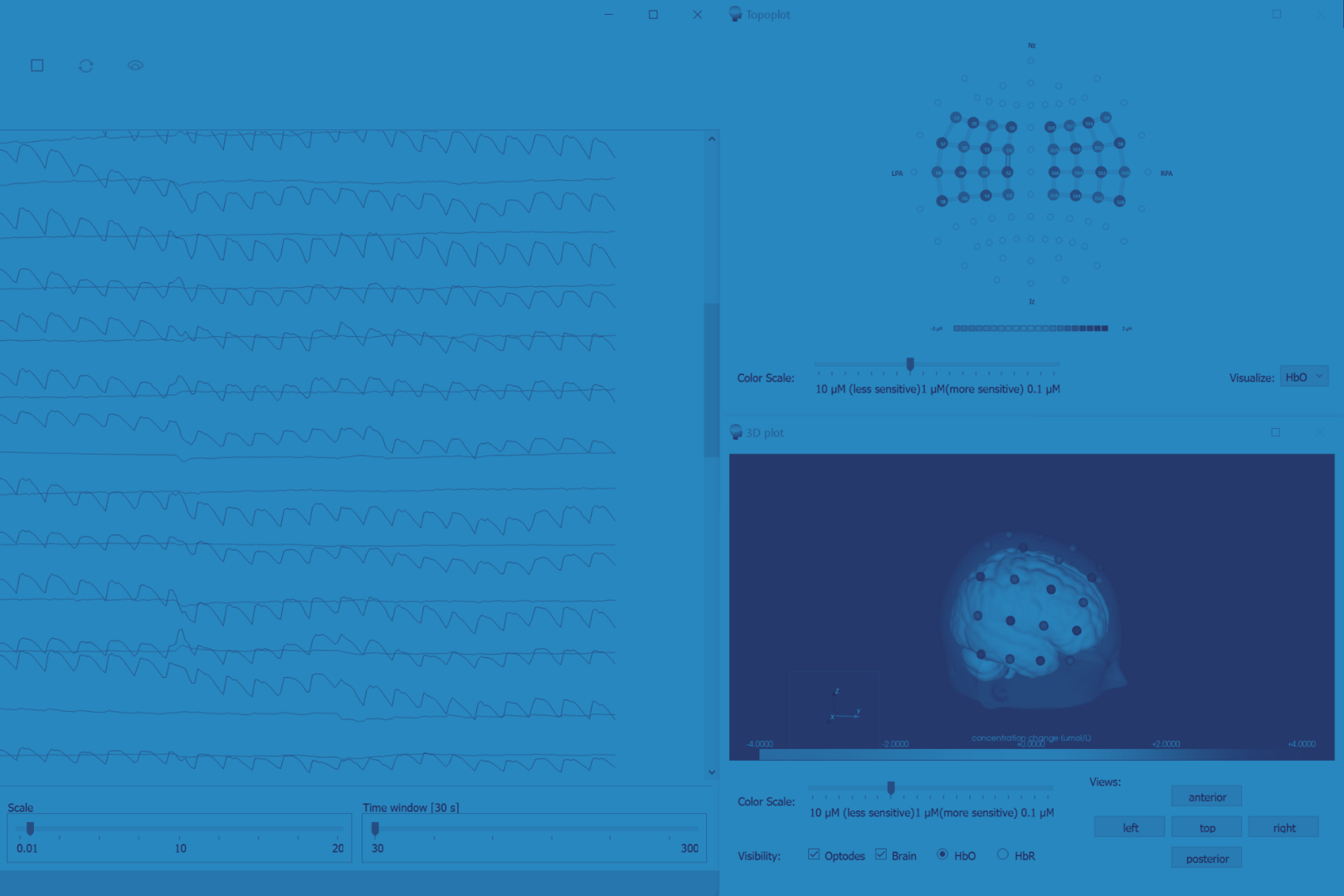 New Aurora with Advanced Multiplexing for High-Density fNIRS