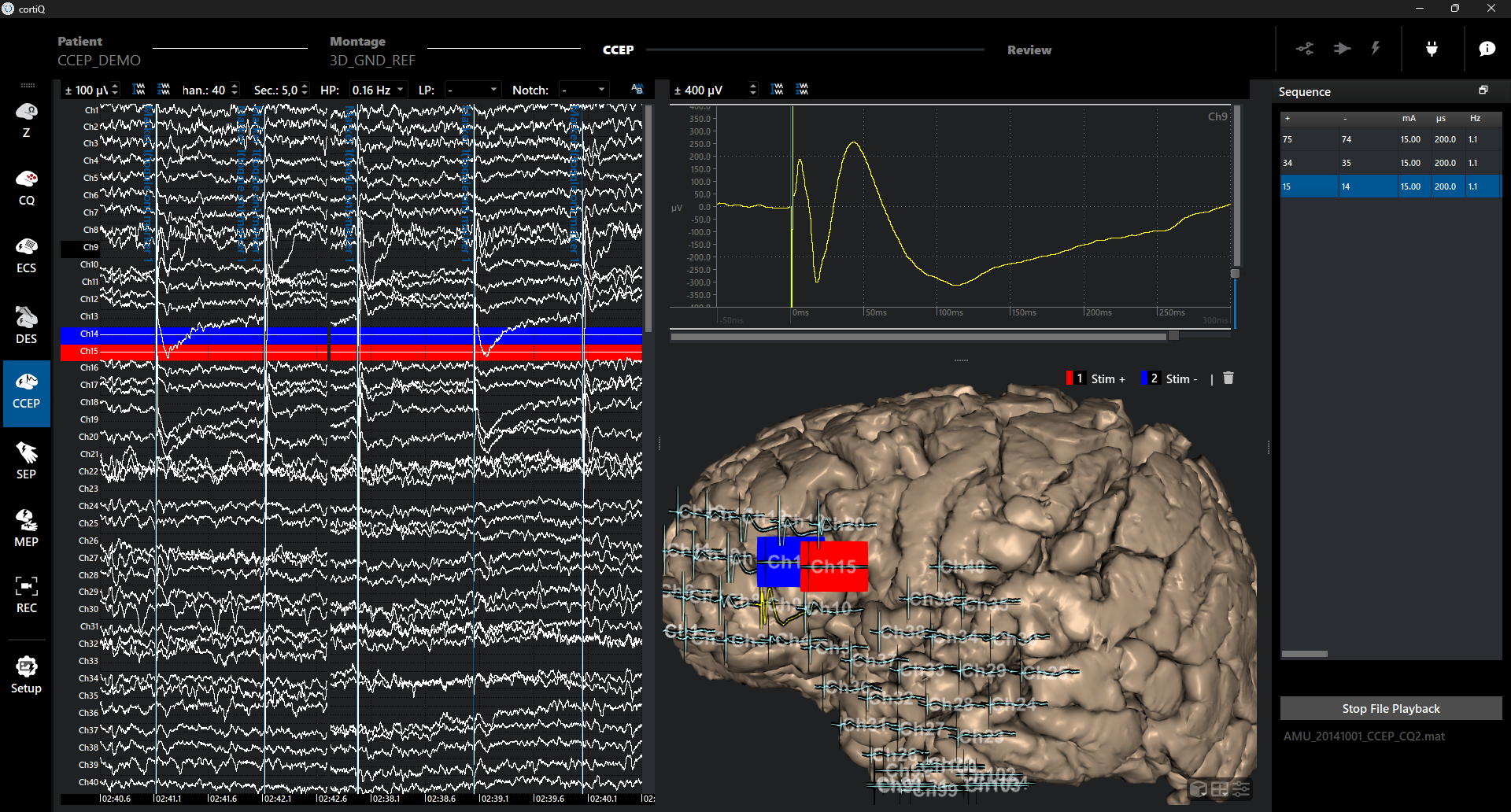When Microstructure Meets Mapping: What a New DES Study Reveals — and Why g.HIamp Matters