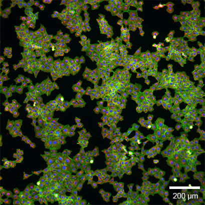 µ-Slide 1 Well – experiment example 1