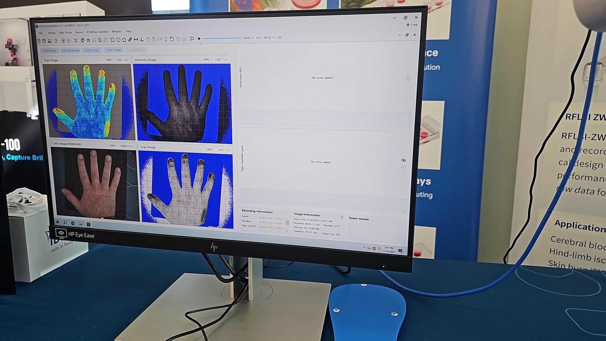 Live laser speckle perfusion imaging of a hand on the RFLSI acquisition software