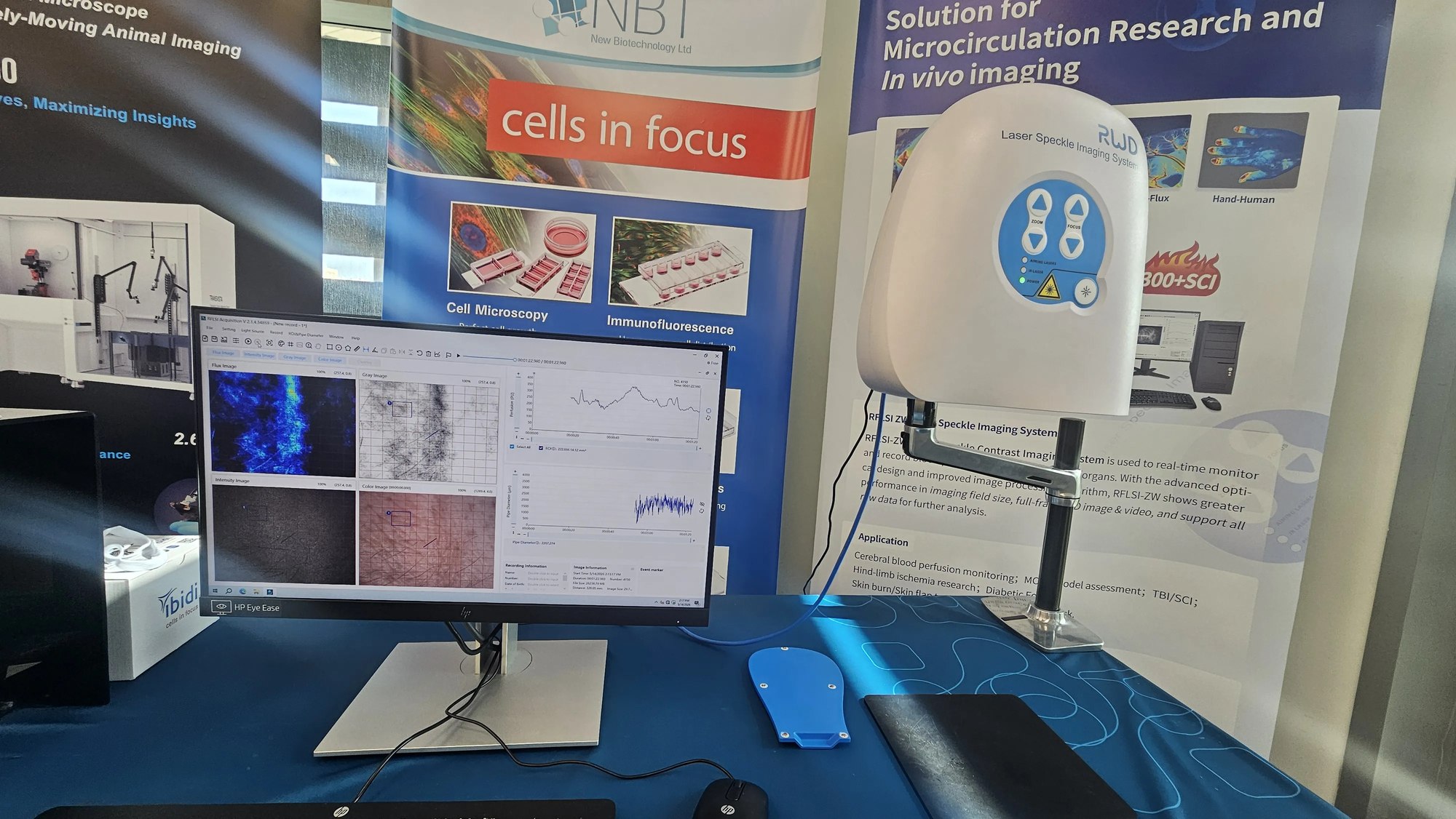 RWD RFLSI-ZW Laser Speckle Imaging System at the NBT booth