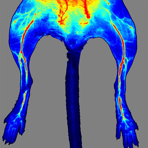 Example laser speckle perfusion image