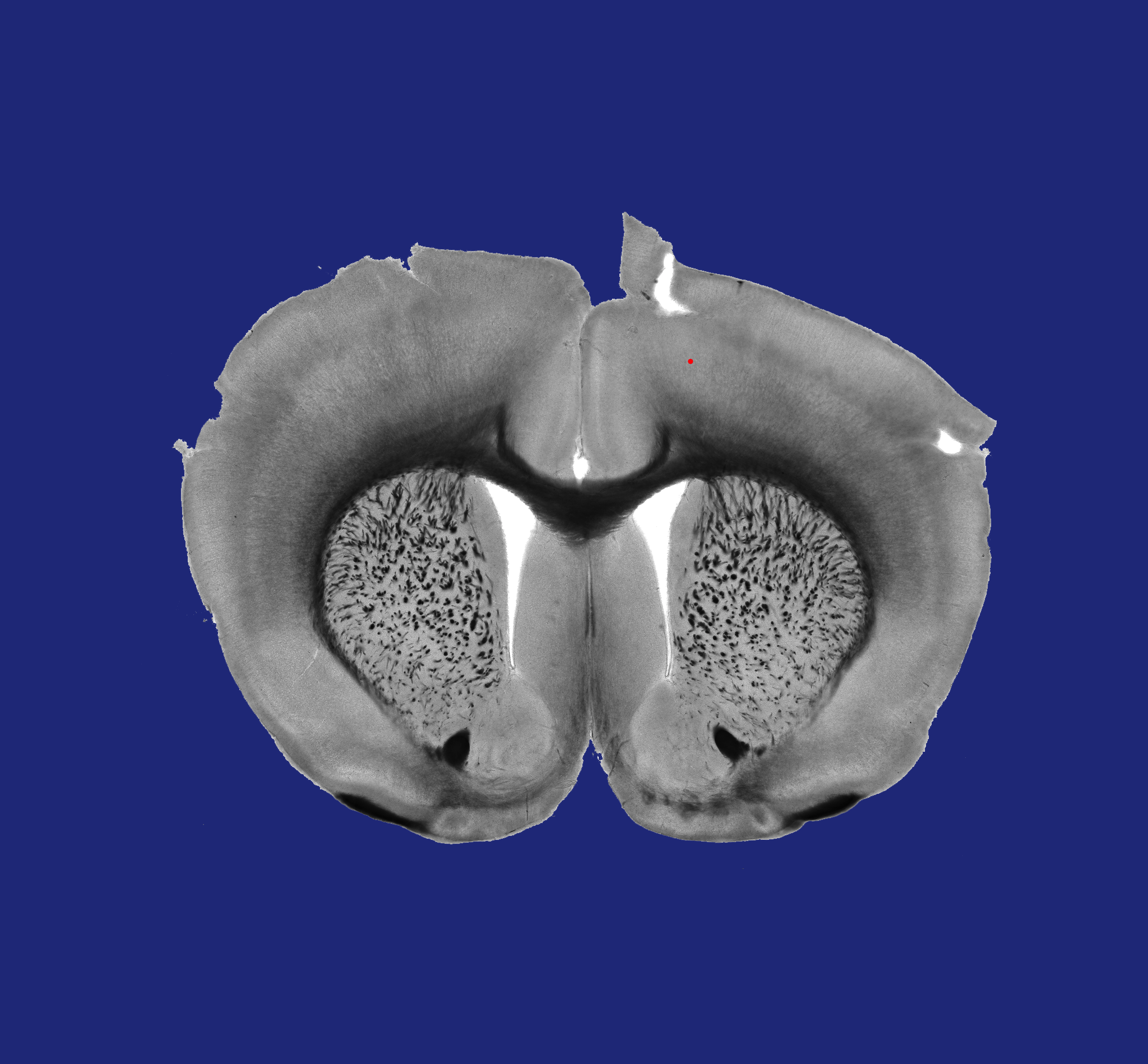 Optogenetics App brain region selection