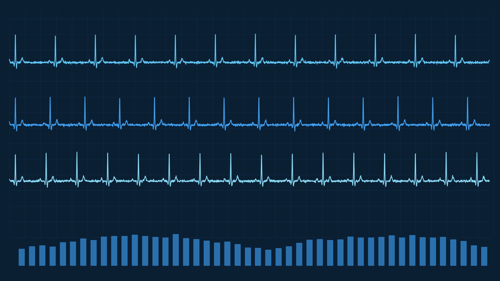 From Data Overload to Confident Interpretation: Advanced Analytics in Preclinical Telemetry