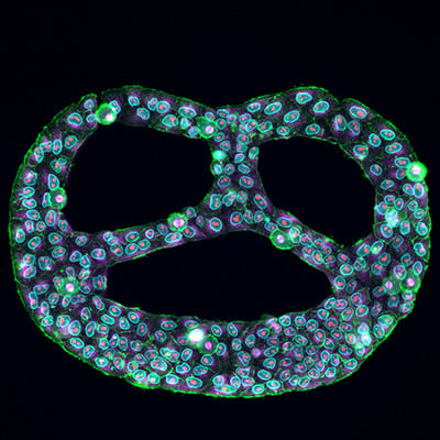 Micropatterning 101: Turning Cell Geometry Into an Experimental Variable