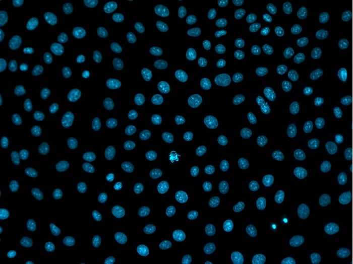 DAPI stained nuclei imaged in ibidi labware
