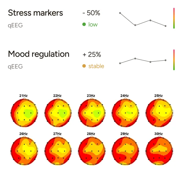 Two sections showing stress markers and mood regulation from qEEG with percentage changes and trend lines; below are 10 colored brain maps at frequencies 21Hz to 30Hz with heatmap patterns.