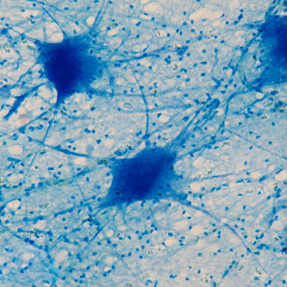 Microscopic view of blue-stained neurons with visible cell bodies and branching dendrites.