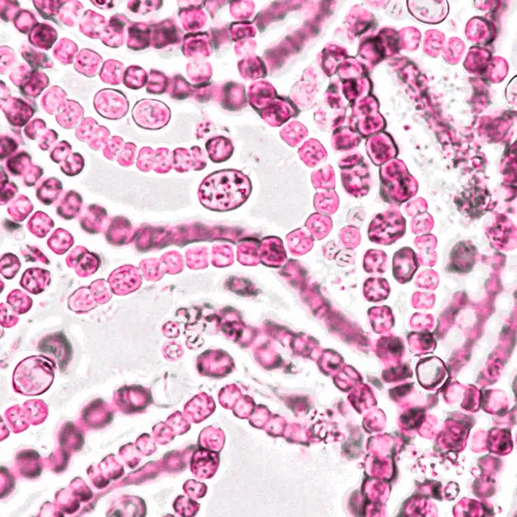 Microscopic image of pink-stained cyanobacteria cells arranged in long, bead-like chains.