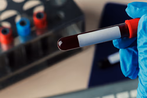 40+ Workplace Bloodborne Pathogens Quiz Questions