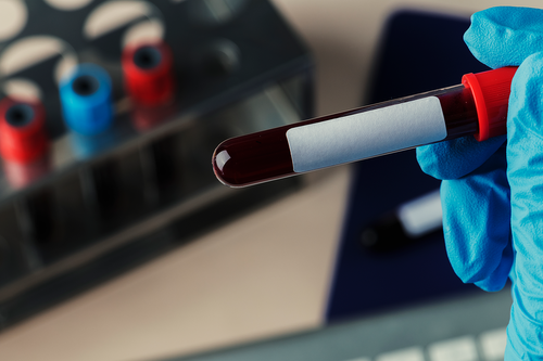 40+ Workplace Bloodborne Pathogens Quiz Questions