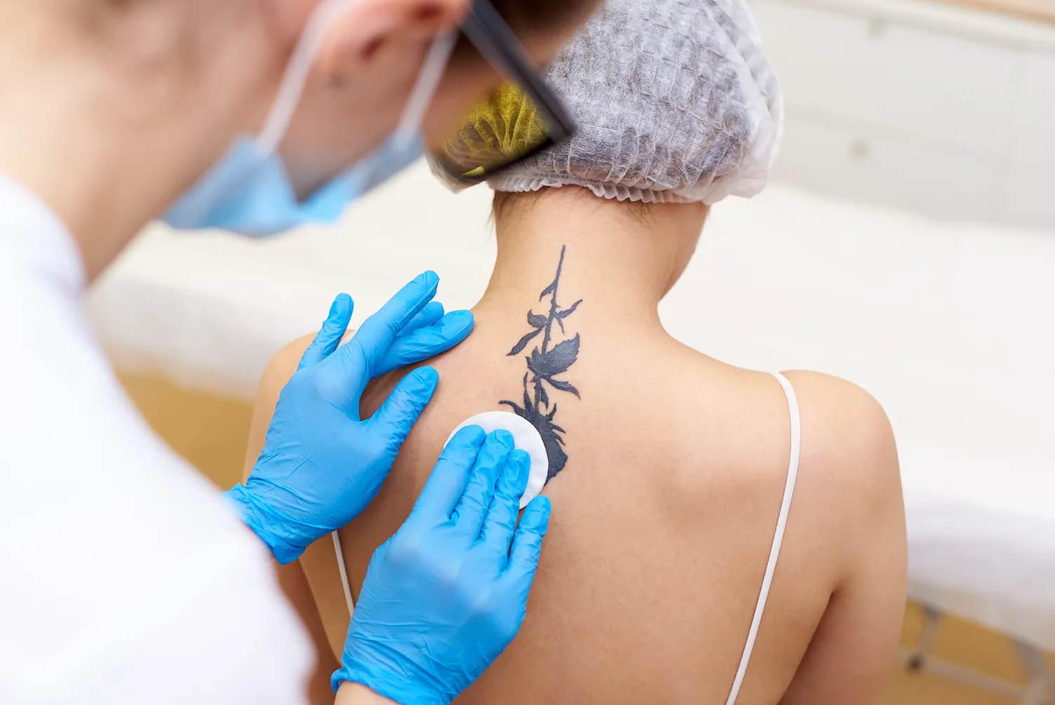 A woman getting tattoo removal