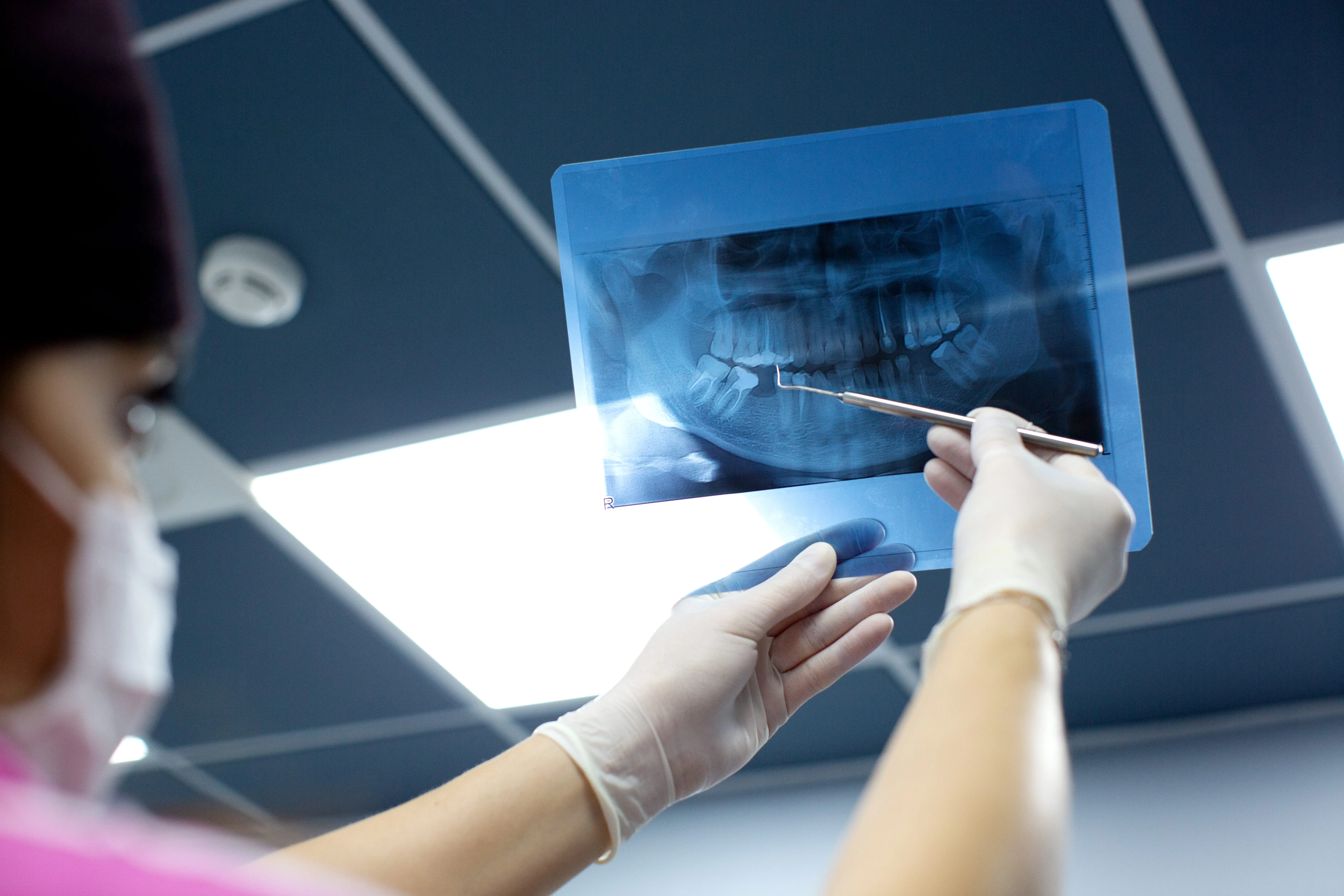 Dentist wearing gloves and mask pointing to a dental X-ray film held up against bright ceiling lights.
